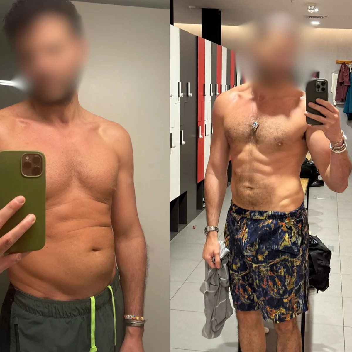 Samer before after results Dubai transformation